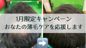 薄毛1月キャンペーン