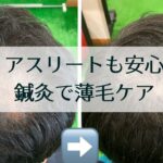アスリートも安心鍼灸で薄毛ケア